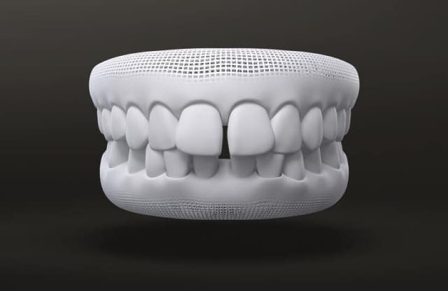 더스퀘어치과 | 치아 교정 보증 범위