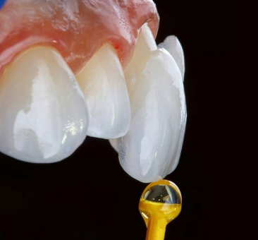더스퀘어치과 | 치과성형 노하우 치아성형