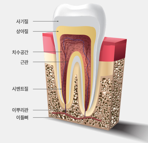 상아질