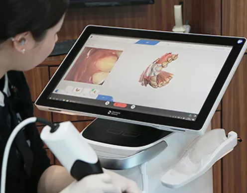 최첨단 시스템을 활용해 디자인 설계 후 개인 치아에 맞춘 미니쉬를 제작 | 3D 구강 스캔