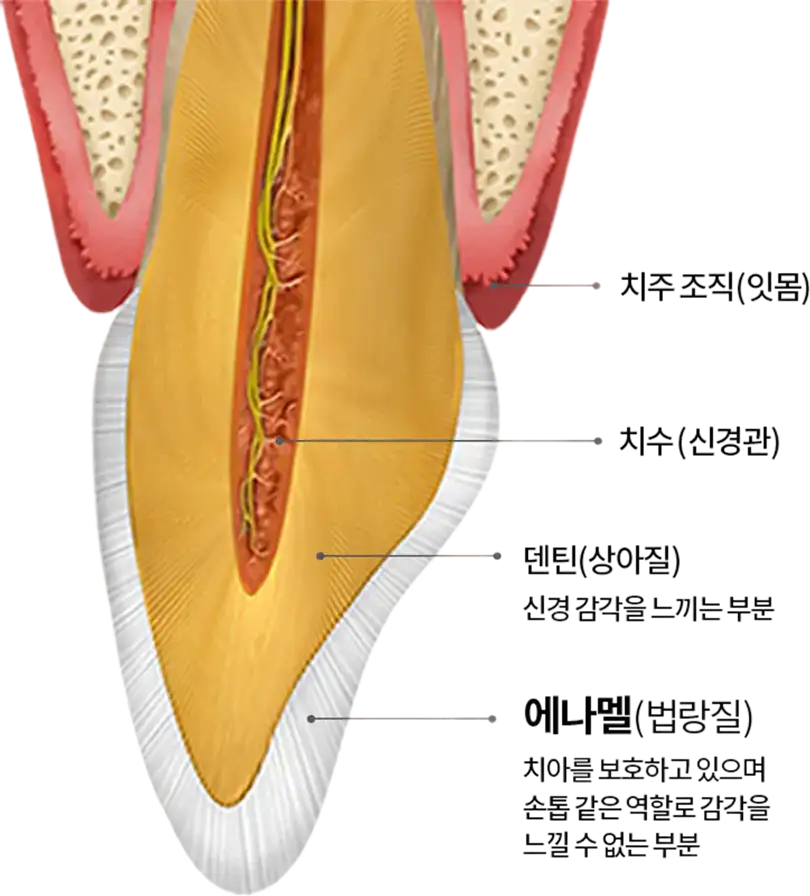 치아는 여러가지 구성 물질로 이뤄진 복합체 | 치아 단면도