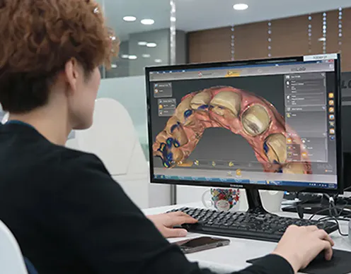 최첨단 시스템을 활용해 디자인 설계 후 개인 치아에 맞춘 미니쉬를 제작 | 전문 기공사 치아 디자인