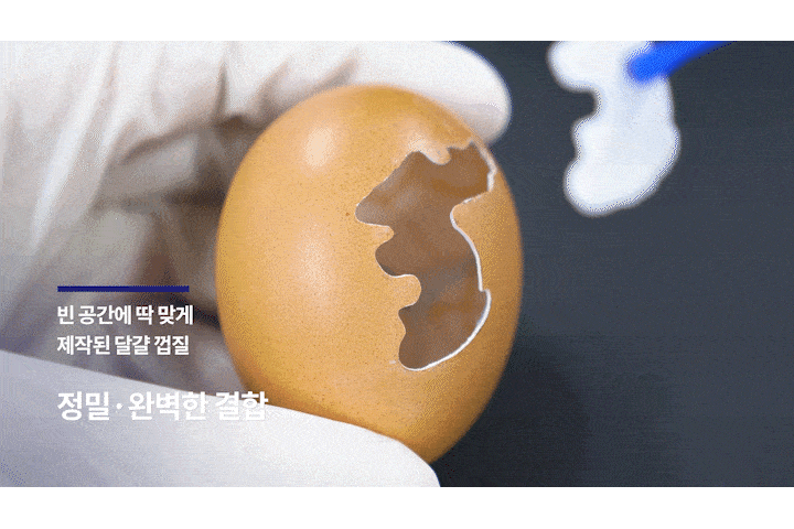 더스퀘어치과 미니쉬 정밀도
