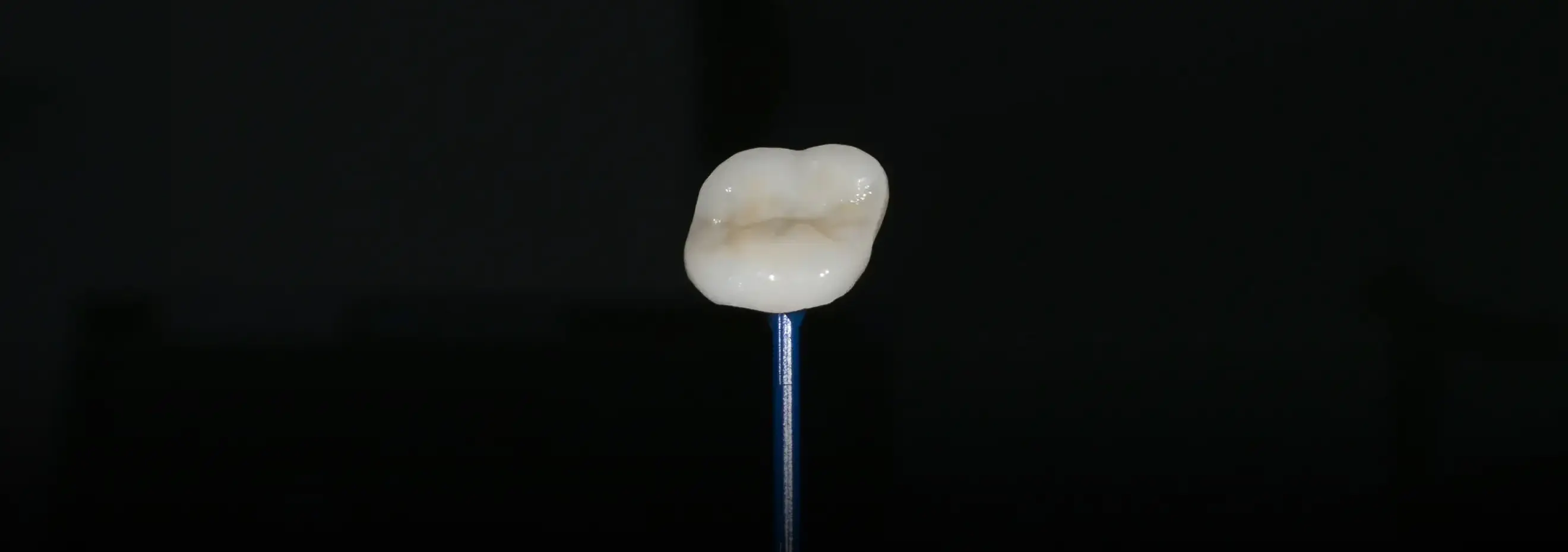 치아를 적게 깎아 치아를 오래 보존할 수 있는 컨셉(minimally invasive)