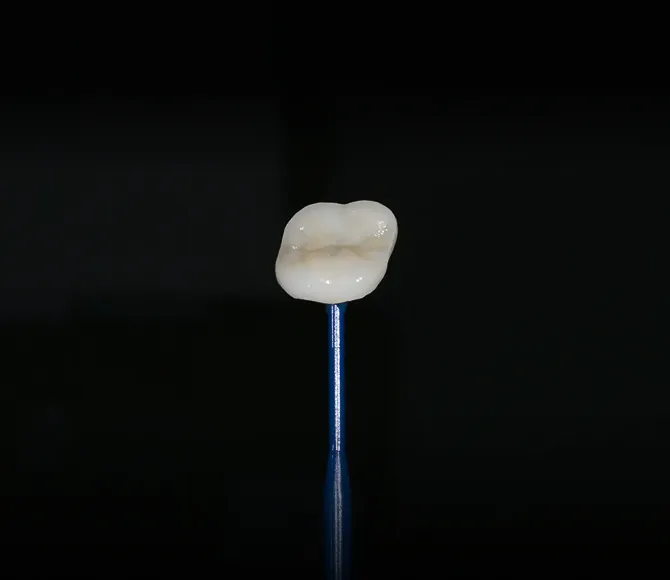 치아를 적게 깎아 치아를 오래 보존할 수 있는 컨셉(minimally invasive)