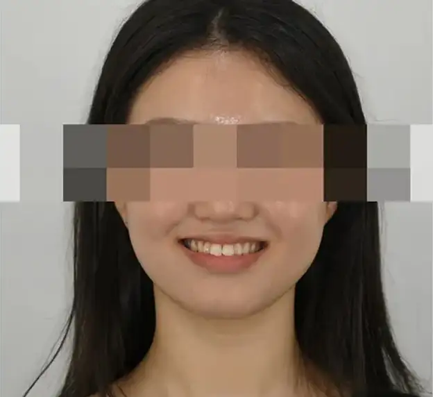 진짜 교정은 얼굴을 함께 보아야만 합니다.