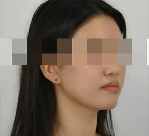 진짜 교정은 얼굴을 함께 보아야만 합니다.