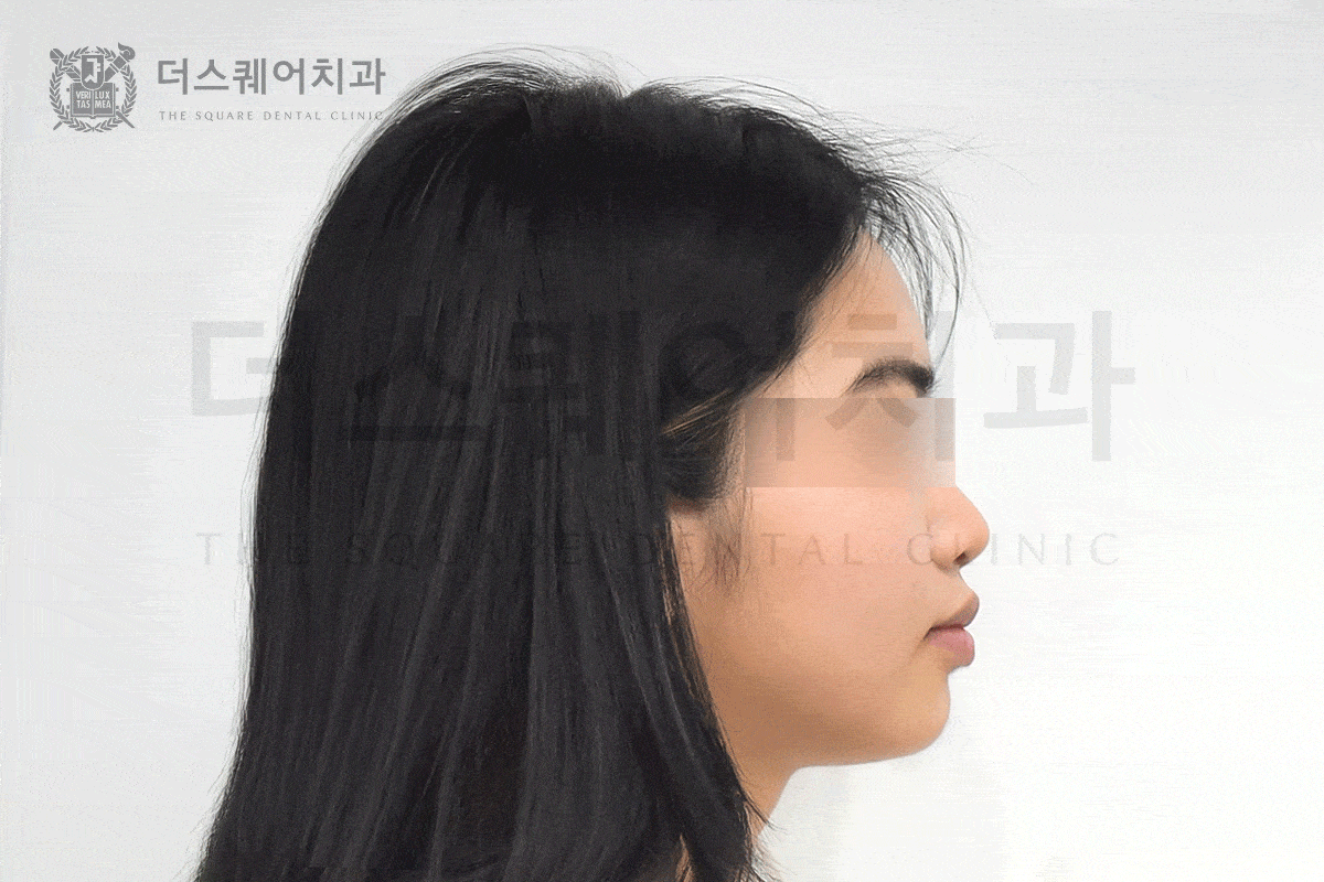 첫인상을 바꾸는 진짜 교정