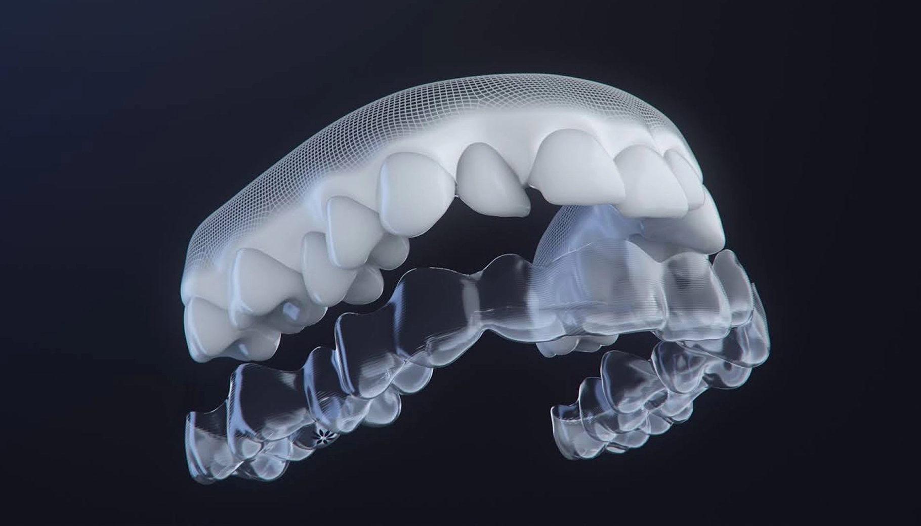 더스퀘어치과 복구치료 치아교정 장치별 치아교정 3D 투명교정 인비절라인