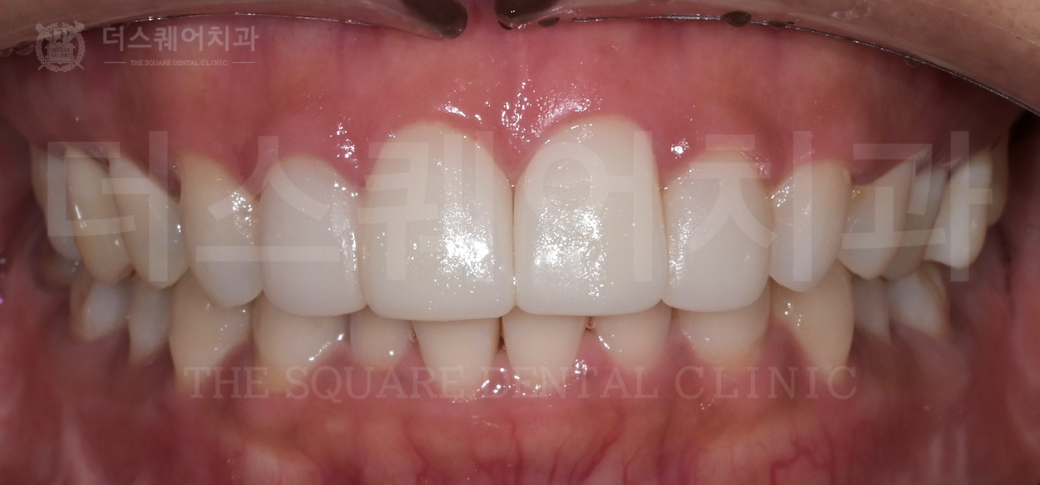 <br />
<b>Warning</b>:  Undefined variable $ba_title in <b>/home/thesquaredc.co.kr/clinical-case/clinicalcase.php</b> on line <b>608</b><br />
