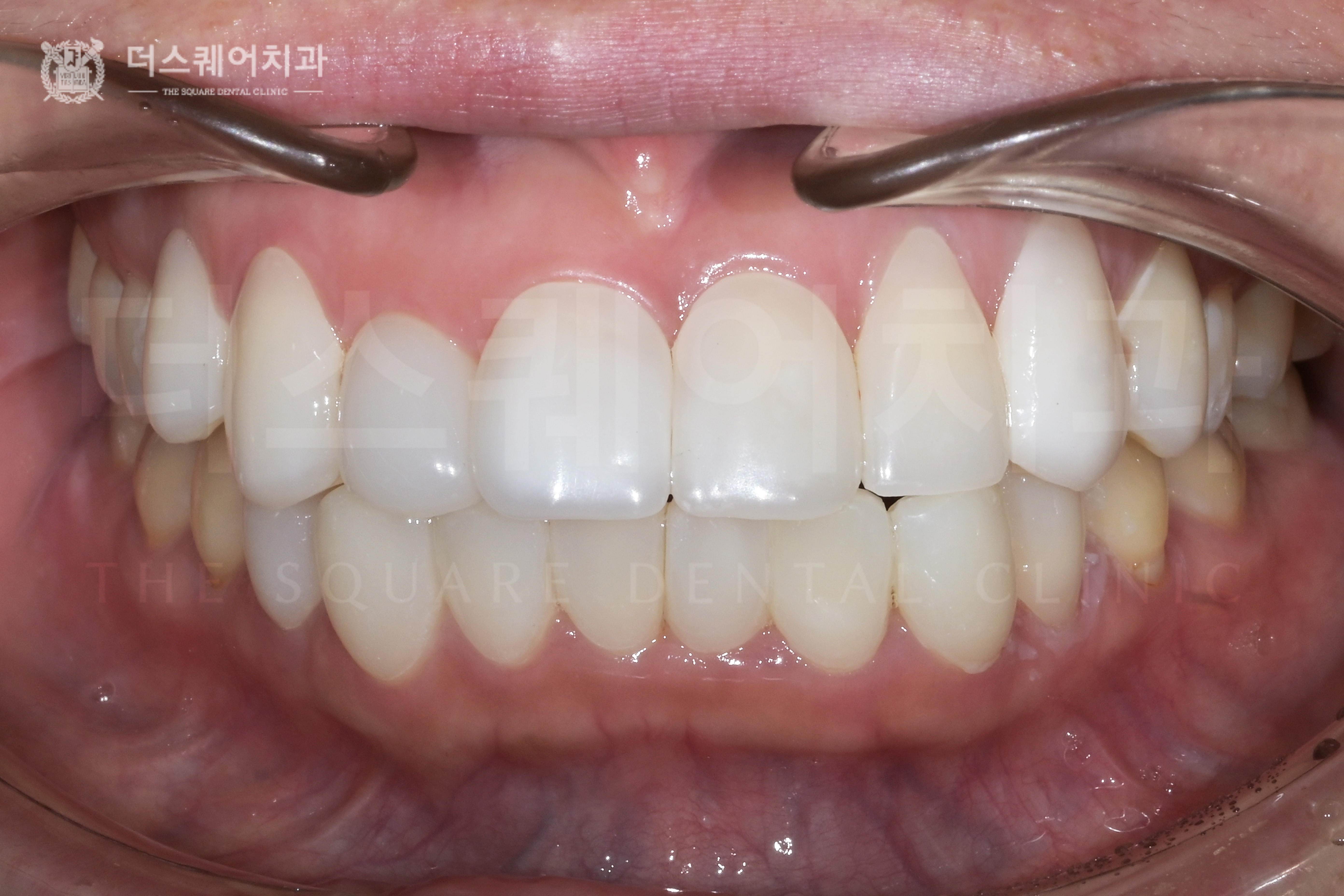 <br />
<b>Warning</b>:  Undefined variable $ba_title in <b>/home/thesquaredc.co.kr/clinical-case/clinicalcase.php</b> on line <b>608</b><br />
