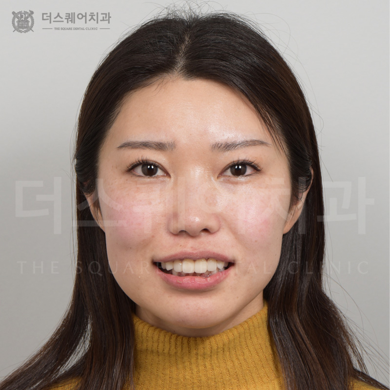 <br />
<b>Warning</b>:  Undefined variable $ba_title in <b>/home/thesquaredc.co.kr/clinical-case/clinicalcase.php</b> on line <b>608</b><br />
