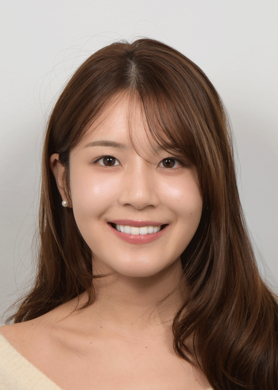 치아 배열과 색상을 비니어큐브로 하루만에 해결한 케이스