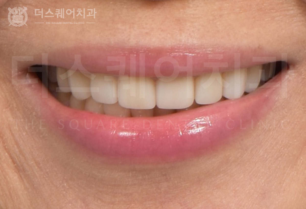 <br />
<b>Warning</b>:  Undefined variable $ba_title in <b>/home/thesquaredc.co.kr/clinical-case/clinicalcase.php</b> on line <b>608</b><br />
