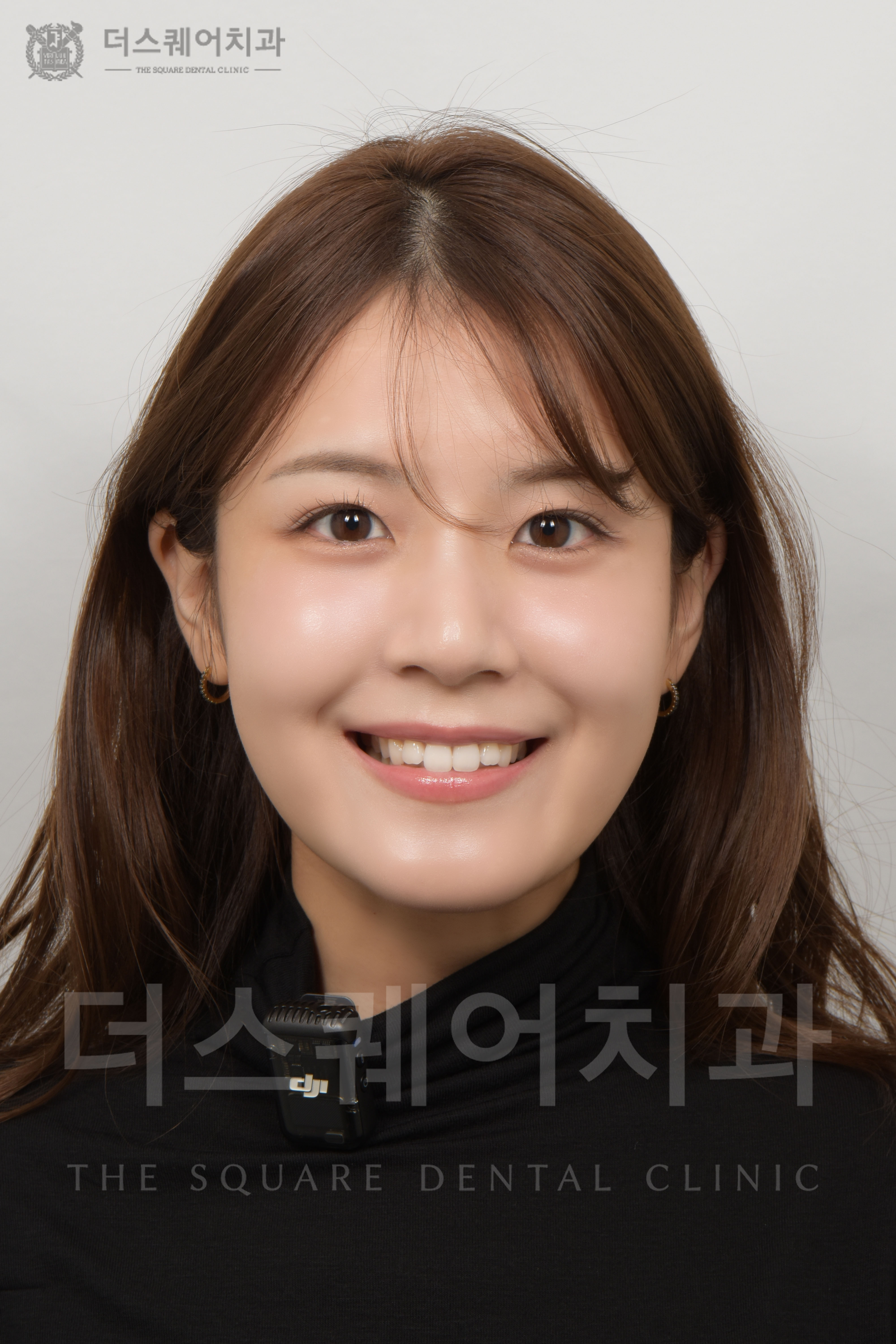 변색, 손상된 치아복구를 위한 비니어큐브 심미치료
