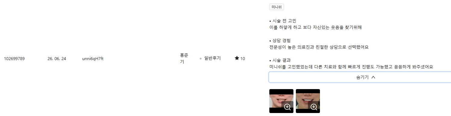 강남언니-광화문치과-2026년 6월의 리뷰