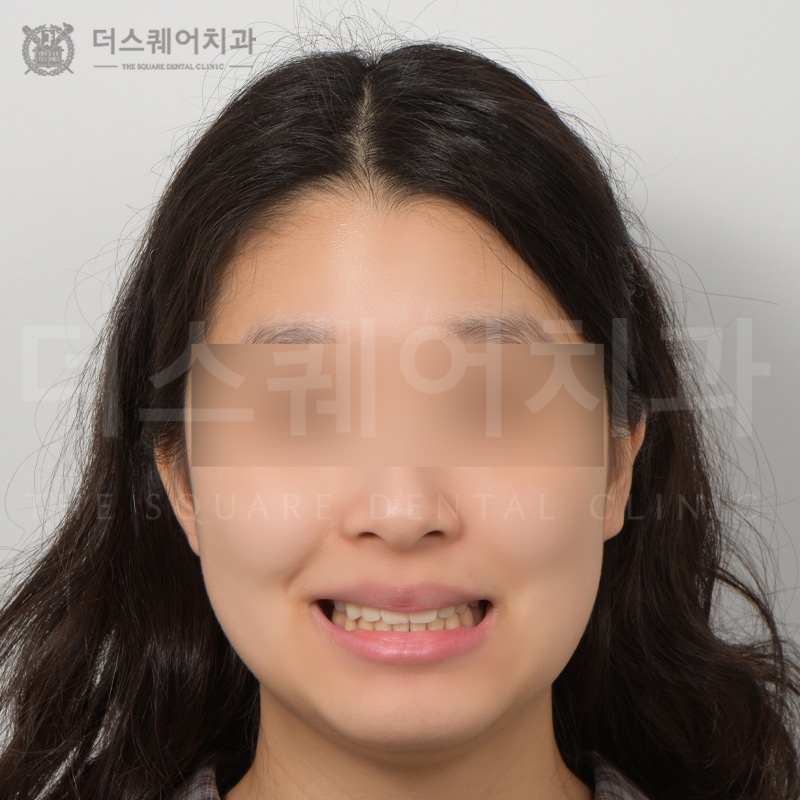 <br />
<b>Warning</b>:  Undefined variable $ba_title in <b>/home/thesquaredc.co.kr/clinical-case/clinicalcase.php</b> on line <b>608</b><br />
