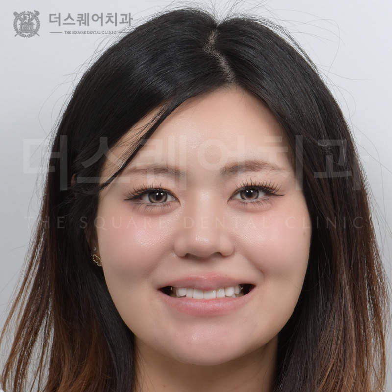 <br />
<b>Warning</b>:  Undefined variable $ba_title in <b>/home/thesquaredc.co.kr/clinical-case/clinicalcase.php</b> on line <b>608</b><br />
